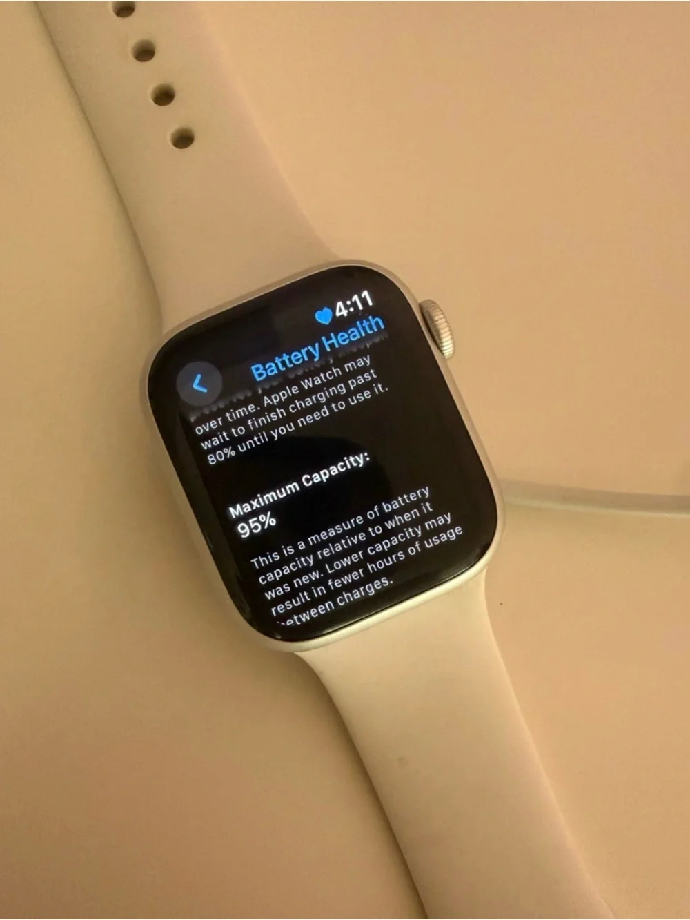 Apple watch series